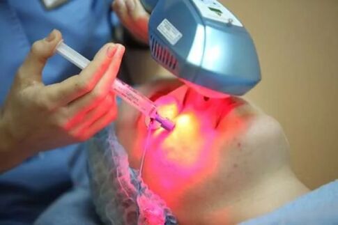 Лазерна биоревитализация на кожата на лицето